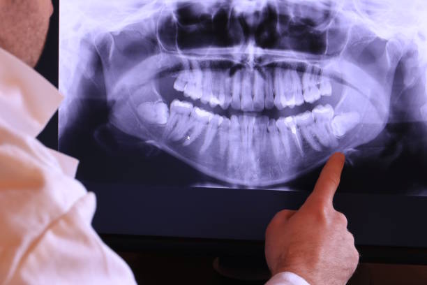 Best Broken or Chipped Tooth Repair in Bellville, OH
